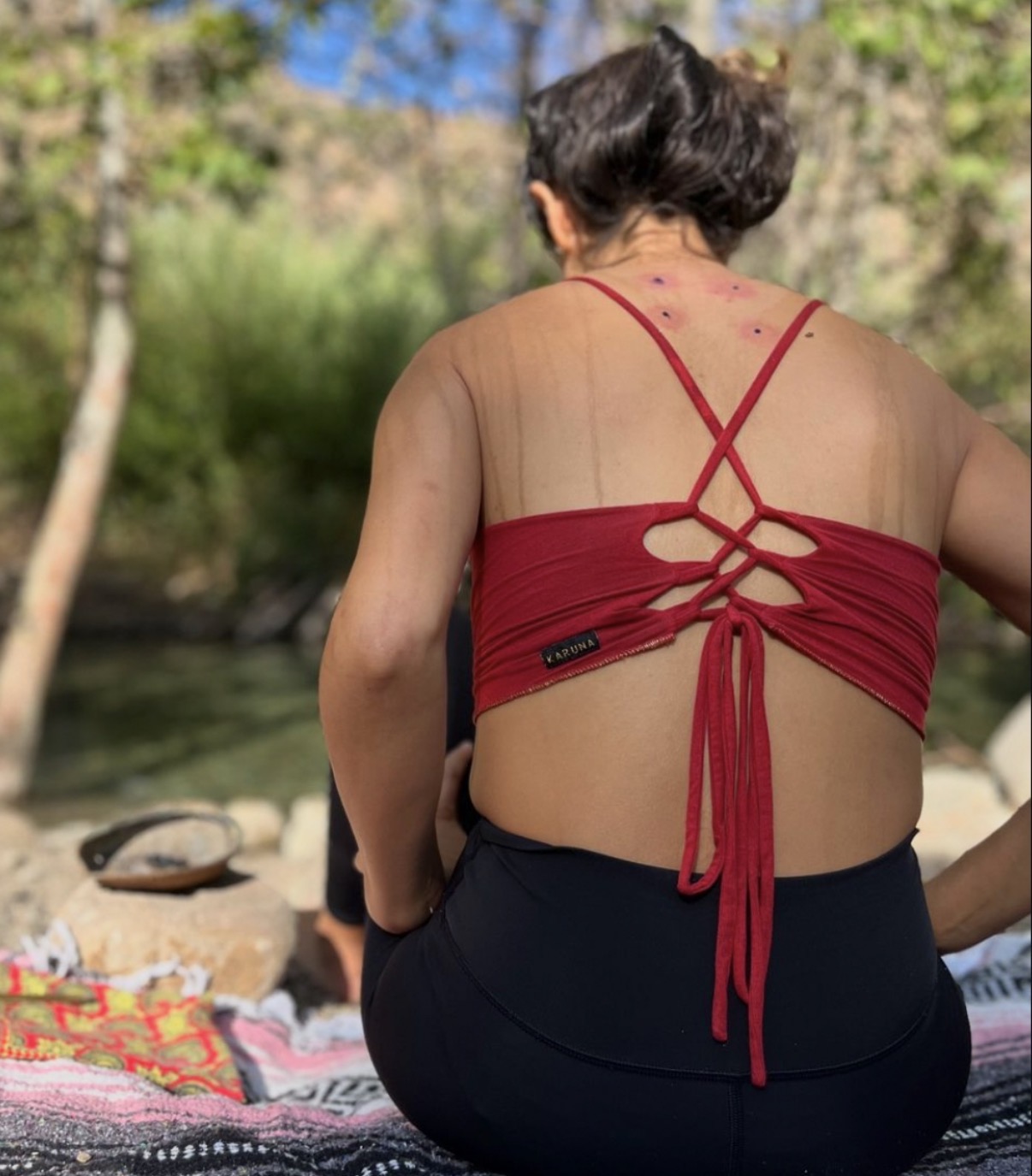 A woman seated by the creek showing fresh Kambo points along her upper back