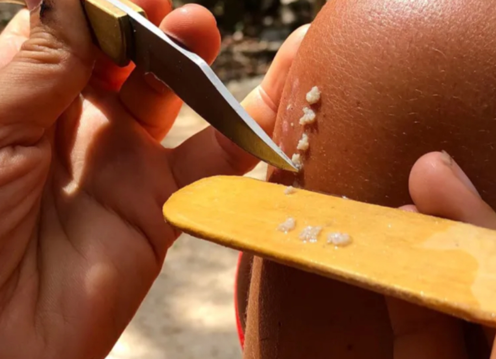 Kambo one-to-one medicine setting